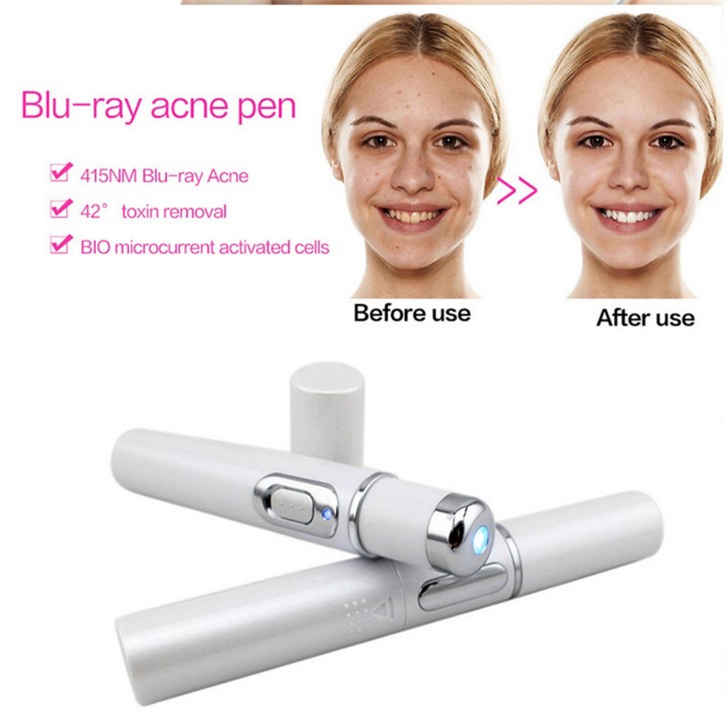 Want to keep young and  beauty? Yes!!!    Wrinkle Removal Treatment - Blue Light Therapy - Laser Pen - BUY NOW! Almost FREE.