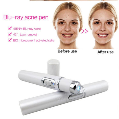 Want to keep young and  beauty? Yes!!!    Wrinkle Removal Treatment - Blue Light Therapy - Laser Pen - BUY NOW! Almost FREE.