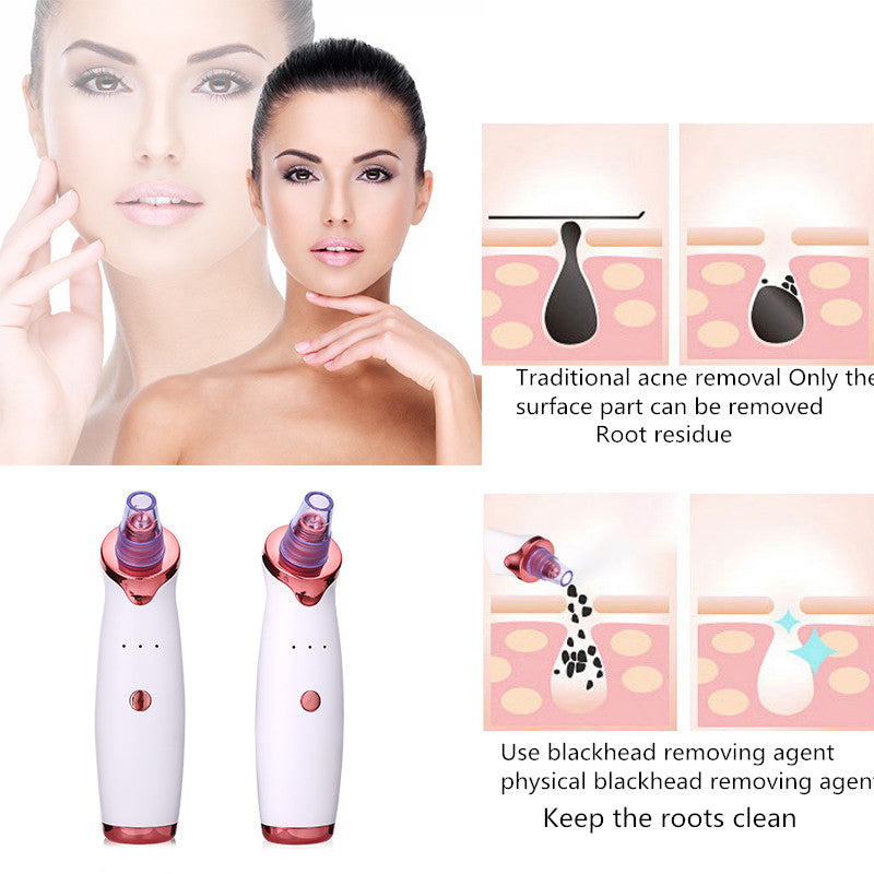 Black Dot Remover - Acne Vacuum Suction - Beauty Skin Care Tool