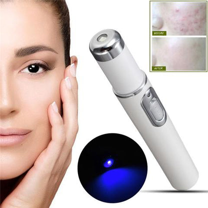 Want to keep young and  beauty? Yes!!!    Wrinkle Removal Treatment - Blue Light Therapy - Laser Pen - BUY NOW! Almost FREE.