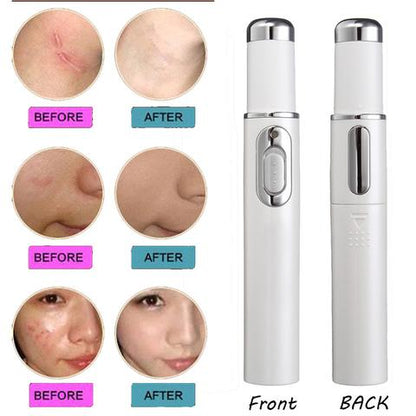 Want to keep young and  beauty? Yes!!!    Wrinkle Removal Treatment - Blue Light Therapy - Laser Pen - BUY NOW! Almost FREE.